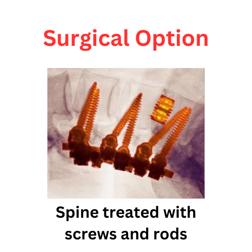 Spine Treated with microscopic needles 1