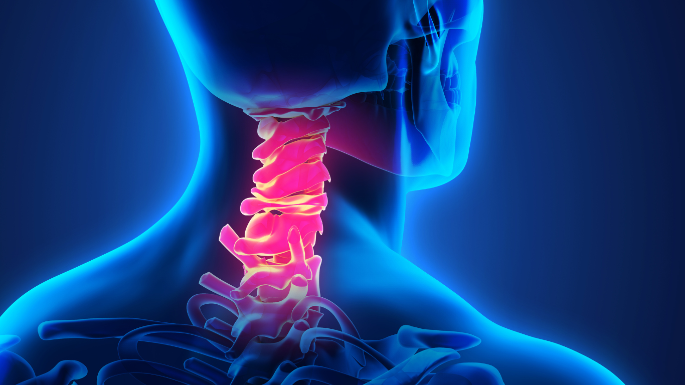 Can an x-ray detect a disc herniation?