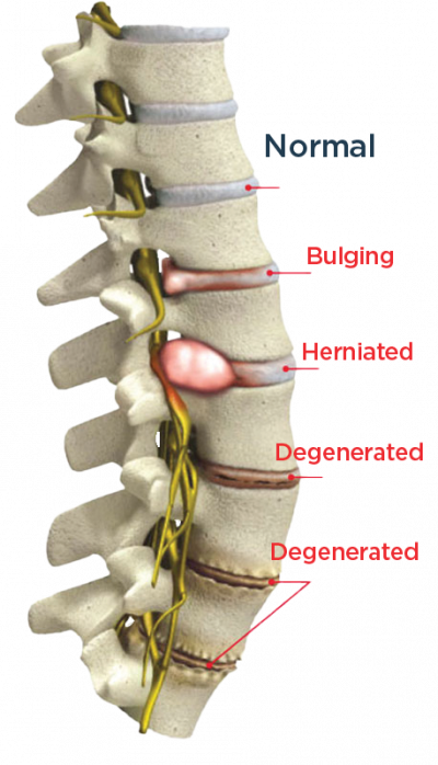 spine conditions 3